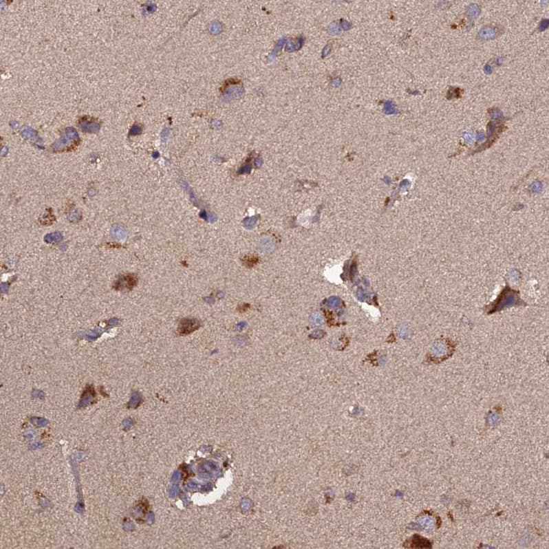 Staining of human Cerebral cortex shows moderate granular cytoplasmic positivity in neuronal cells.