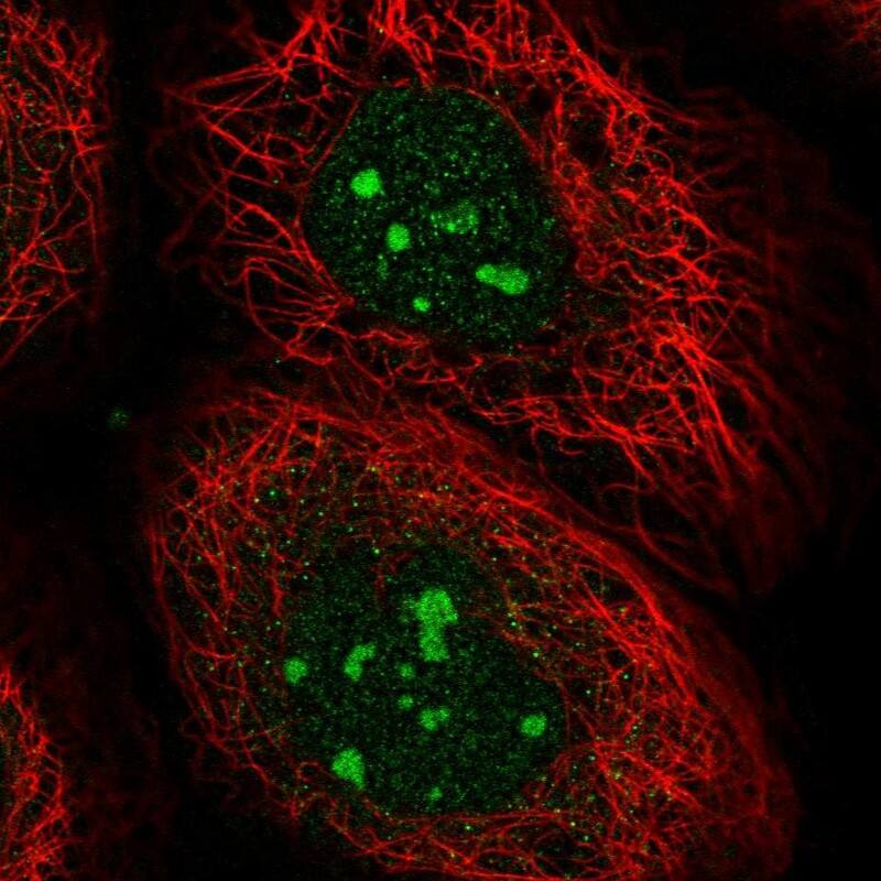 Staining of human cell line A-431 shows localization to nucleoli.