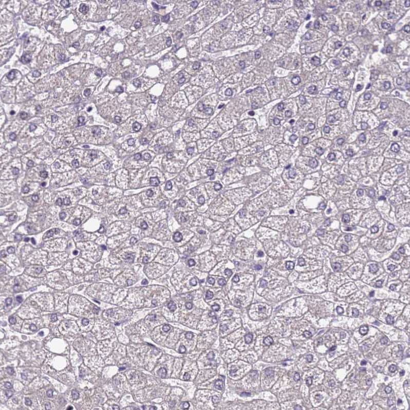Staining of human liver shows very weak nuclear positivity in hepatocytes.