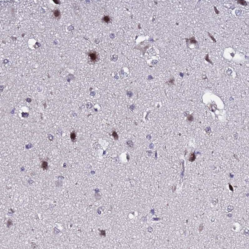 Staining of human cerebral cortex shows moderate nuclear positivity in neurons.