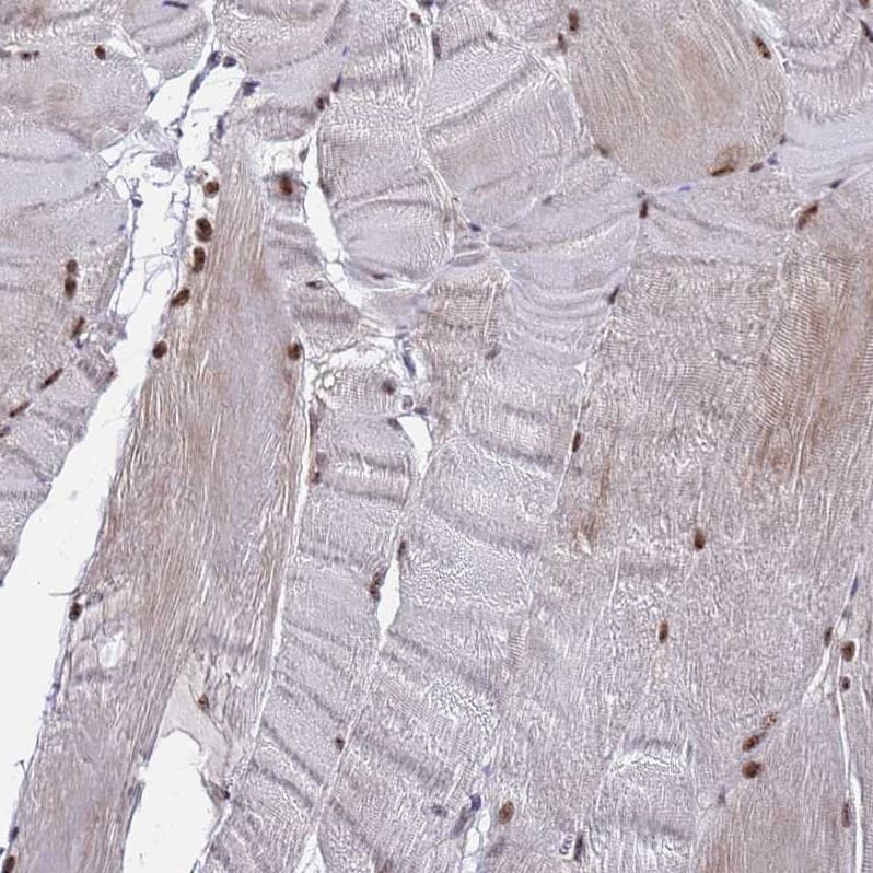 Staining of human skeletal muscle shows strong nuclear positivity in myocytes.
