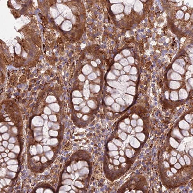 Staining of human rectum shows strong cytoplasmic positivity in glandular cells.