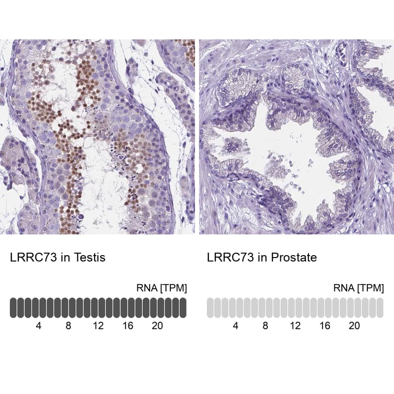 <b>Orthogonal Strategies Validation. </b>Analysis in human testis and prostate tissues using Anti-LRRC73 antibody. Corresponding LRRC73 RNA-seq data are presented for the same tissues.