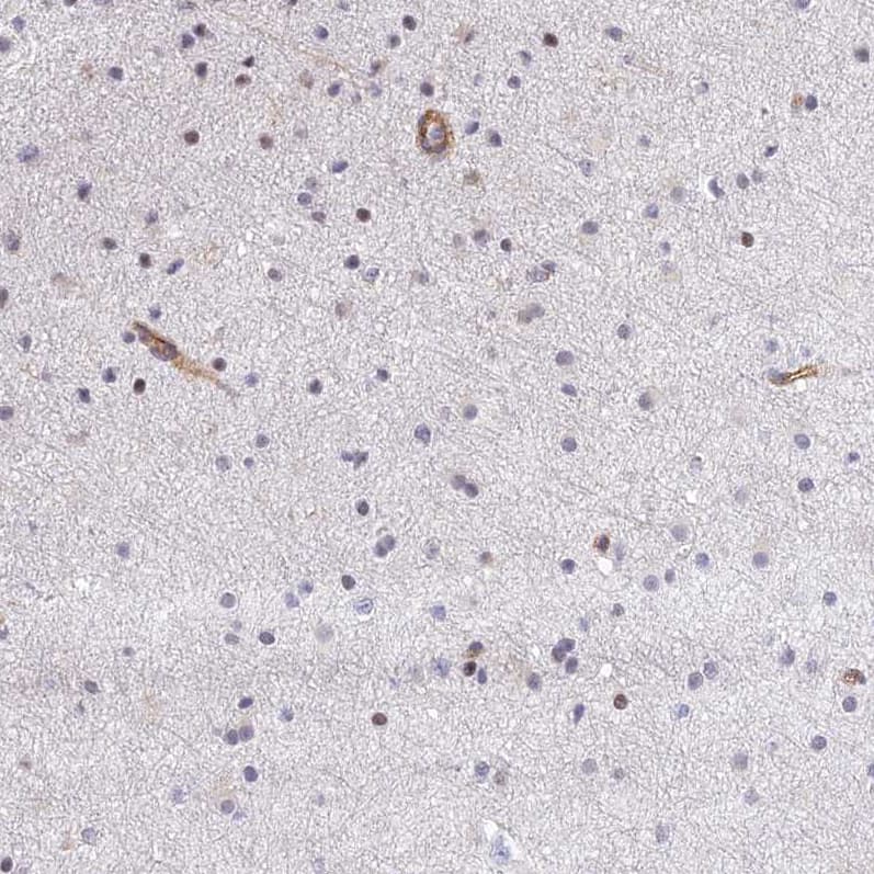 Staining of human cerebral cortex shows moderate cytoplasmic membranous positivity in endothelial cells.