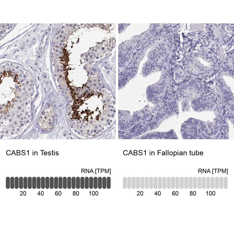 Immunohistochemistry CABS1 Antibody - BSA Free
