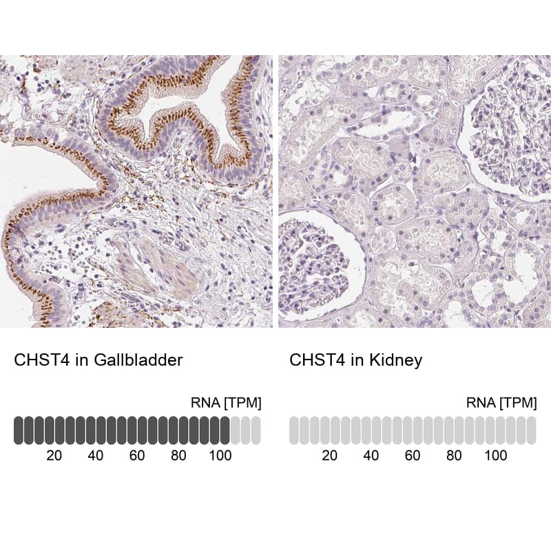 <b>Orthogonal Strategies Validation. </b>Analysis in human gallbladder and kidney tissues using NBP1-91748 antibody. Corresponding CHST4 RNA-seq data are presented for the same tissues.
