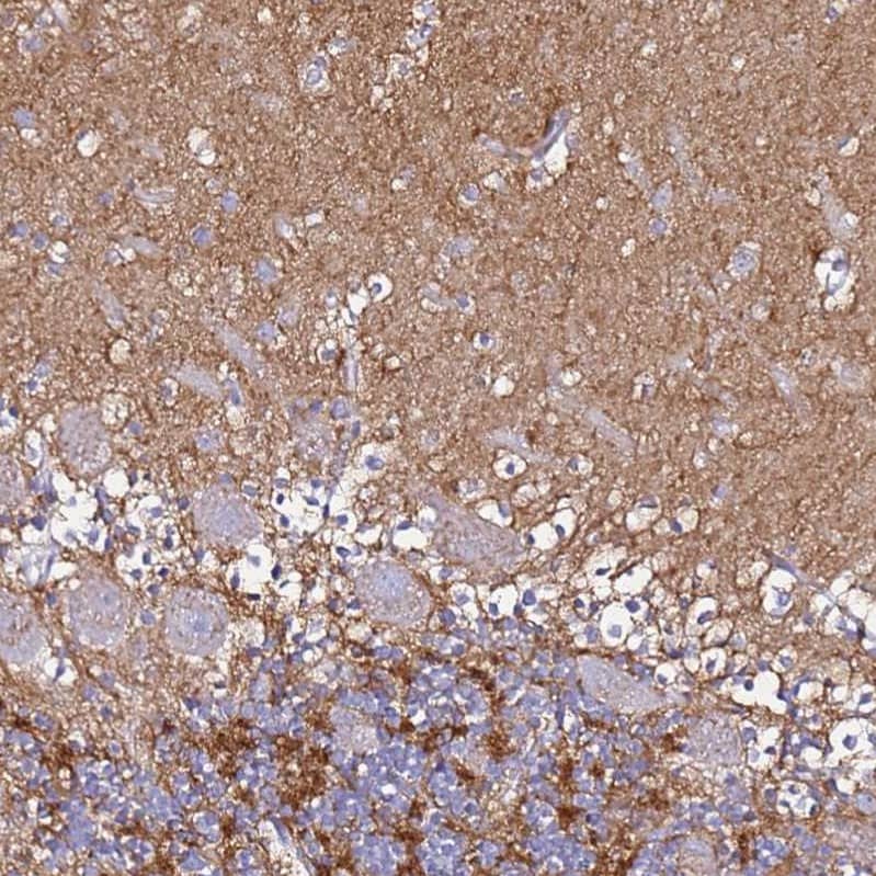 Staining of human cerebellum shows strong cytoplasmic positivity in neuropil.