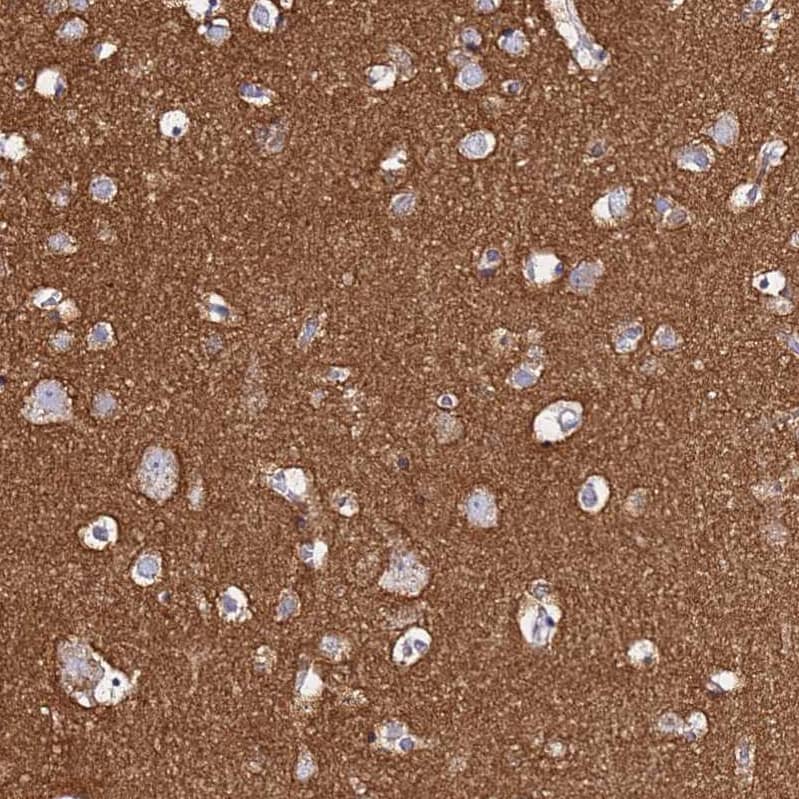 Staining of human cerebral cortex shows strong cytoplasmic positivity in neuropil.