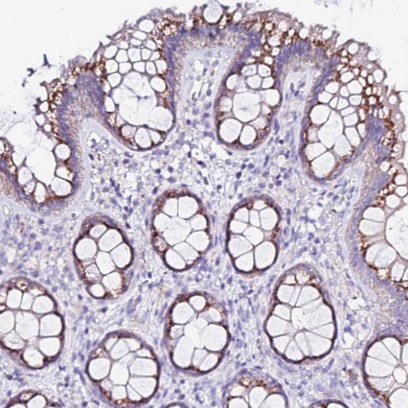 Staining of human colon shows moderate cytoplasmic granular positivity in glandular cells.