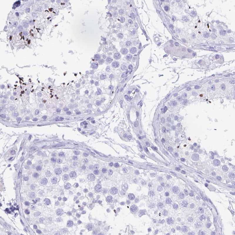 Immunohistochemistry CATSPER4 Antibody - BSA Free