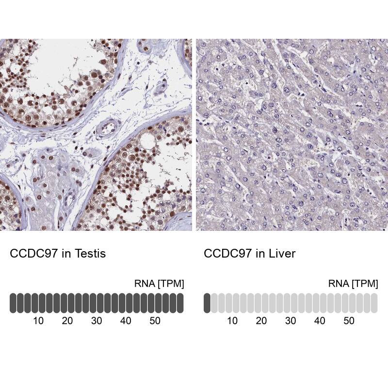 <b>Orthogonal Strategies Validation. </b>Analysis in human testis and liver tissues using Anti-CCDC97 antibody. Corresponding CCDC97 RNA-seq data are presented for the same tissues.