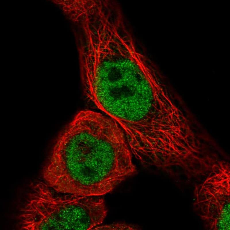 Staining of human cell line A-431 shows localization to nucleoplasm.