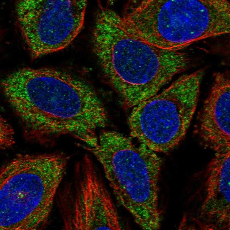 Staining of human cell line SiHa shows localization to cytosol.