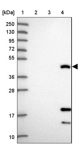Lane 1: Marker [kDa] 250, 130, 95, 72, 55, 36, 28, 17, 10Lane 2: Human cell line RT-4Lane 3: Human cell line U-251MG spLane 4: Human plasma (IgG/HSA depleted)