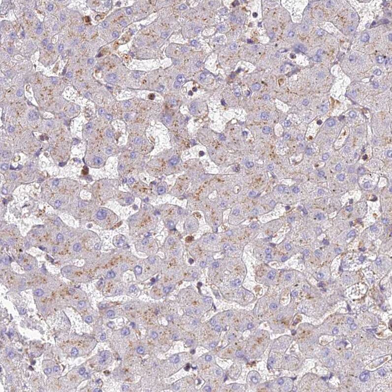 Staining of human liver shows weak granular cytoplasmic positivity in hepatocytes as expected.