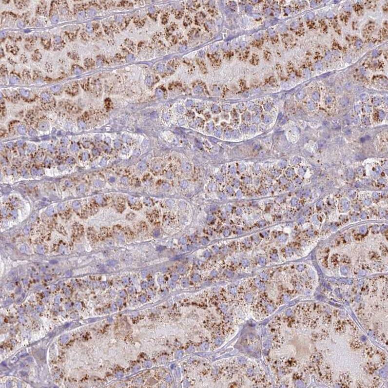 Staining of human kidney shows moderate to strong granular cytoplasmic positivity in cells in tubules.