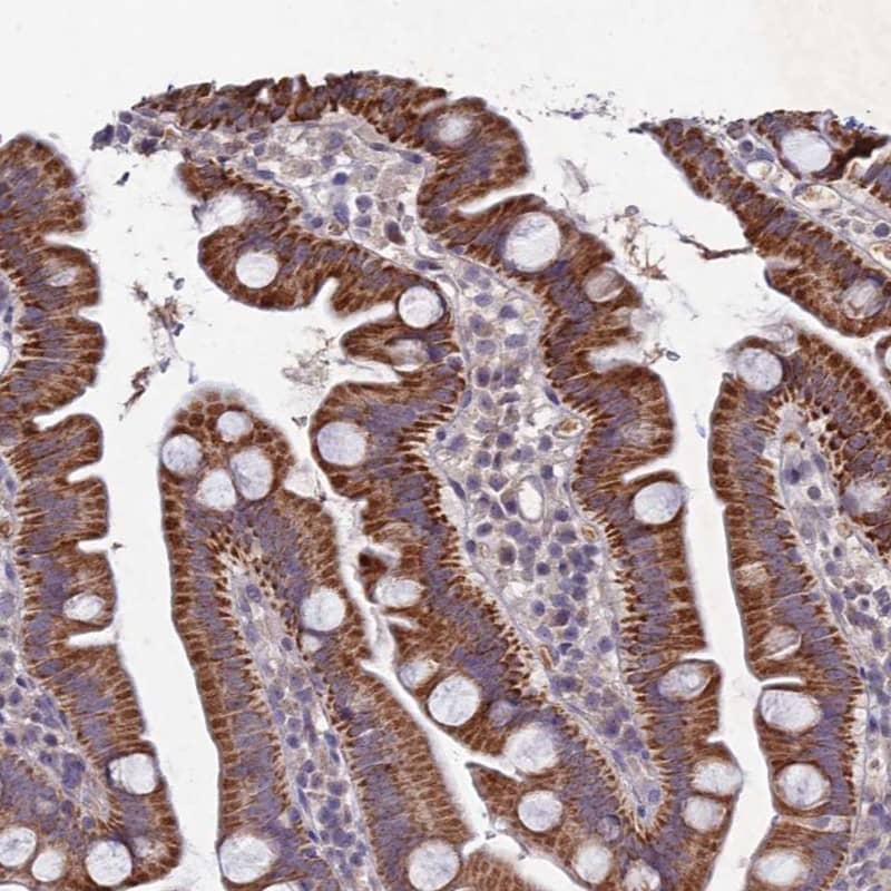 Staining of human small intestine shows high expression.