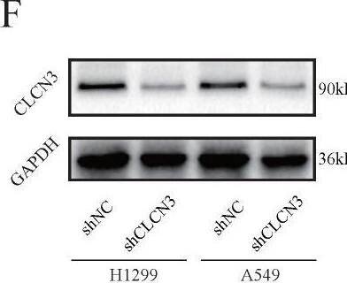  CLCN3 was upregulated in human LUAD and facilitated tumor proliferation and migration. (a, b) Through IHC and IF analysis, the expression of CLCN3 was examined in a tissue microarray of 30 paraffin-embedded LUAD tissues and adjacent normal tissues (ANT) (n = 30). (c, d) In human LUAD cell lines as well as in human bronchial epithelial cell lines, the basic protein expression of CLCN3 was measured (n = 3). (e) The basic RNA level of CLCN3 was detected in human LUAD cell lines and a human bronchial epithelial cell line (n = 3). (f) The protein expression of CLCN3 was inhibited after CLCN3 knockdown in H1299 and A549 cells. (g) RNA-seq was constructed after CLCN3 knockdown in H1299 cells. Locomotion and growth were significantly enriched as illustrated by GO analysis. (h) Knockdown of CLCN3 suppressed the clonogenicity of H1299 and A549 cells (n = 3). (i) CLCN3 knockdown suppressed the invasion of H1299 and A549 cells (n = 3). *P < 0.05. Image collected and cropped by CiteAb from the following open publication (//pubmed.ncbi.nlm.nih.gov/36439880), licensed under a CC-BY license. Not internally tested by Novus Biologicals.