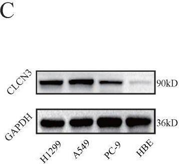  CLCN3 was upregulated in human LUAD and facilitated tumor proliferation and migration. (a, b) Through IHC and IF analysis, the expression of CLCN3 was examined in a tissue microarray of 30 paraffin-embedded LUAD tissues and adjacent normal tissues (ANT) (n = 30). (c, d) In human LUAD cell lines as well as in human bronchial epithelial cell lines, the basic protein expression of CLCN3 was measured (n = 3). (e) The basic RNA level of CLCN3 was detected in human LUAD cell lines and a human bronchial epithelial cell line (n = 3). (f) The protein expression of CLCN3 was inhibited after CLCN3 knockdown in H1299 and A549 cells. (g) RNA-seq was constructed after CLCN3 knockdown in H1299 cells. Locomotion and growth were significantly enriched as illustrated by GO analysis. (h) Knockdown of CLCN3 suppressed the clonogenicity of H1299 and A549 cells (n = 3). (i) CLCN3 knockdown suppressed the invasion of H1299 and A549 cells (n = 3). *P < 0.05. Image collected and cropped by CiteAb from the following open publication (//pubmed.ncbi.nlm.nih.gov/36439880), licensed under a CC-BY license. Not internally tested by Novus Biologicals.
