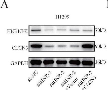  HNRNPK knockdown inhibited the expression and function of CLCN3 in vitro. (a) The expression of CLCN3 was inhibited after HNRNPK knockdown but this inhibition was abrogated by CLCN3 upregulation. (b) Following HNRNPK knockdown, there was a decrease in the proliferation of LUAD cells, however, this decrease was restored by the upregulation of CLCN3 (n = 3). (c) The representative cell images showed that HNRNPK knockdown inhibited the cell proliferation at 24 h and was rescued by CLCN3 overexpression. (d) Cell clonogenicity was alleviated as a result of HNRNPK knockdown, and this reduction was restored by the upregulation of CLCN3 (n = 3). (e) The cell invasion was suppressed following HNRNPK knockdown, and this inhibition was rescued by CLCN3 upregulation (n = 3). *P < 0.05. Image collected and cropped by CiteAb from the following open publication (//pubmed.ncbi.nlm.nih.gov/36439880), licensed under a CC-BY license. Not internally tested by Novus Biologicals.