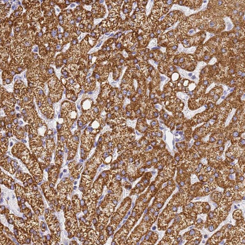 Staining of human liver shows strong cytoplasmic granular positivity in hepatocytes.
