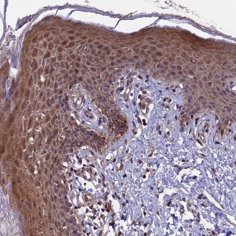 Staining of human skin shows strong cytoplasmic positivity in squamous epithelial cells.