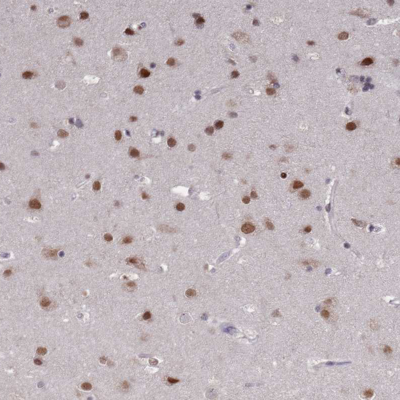 Staining of human cerebral cortex shows strong nuclear positivity in neurons.