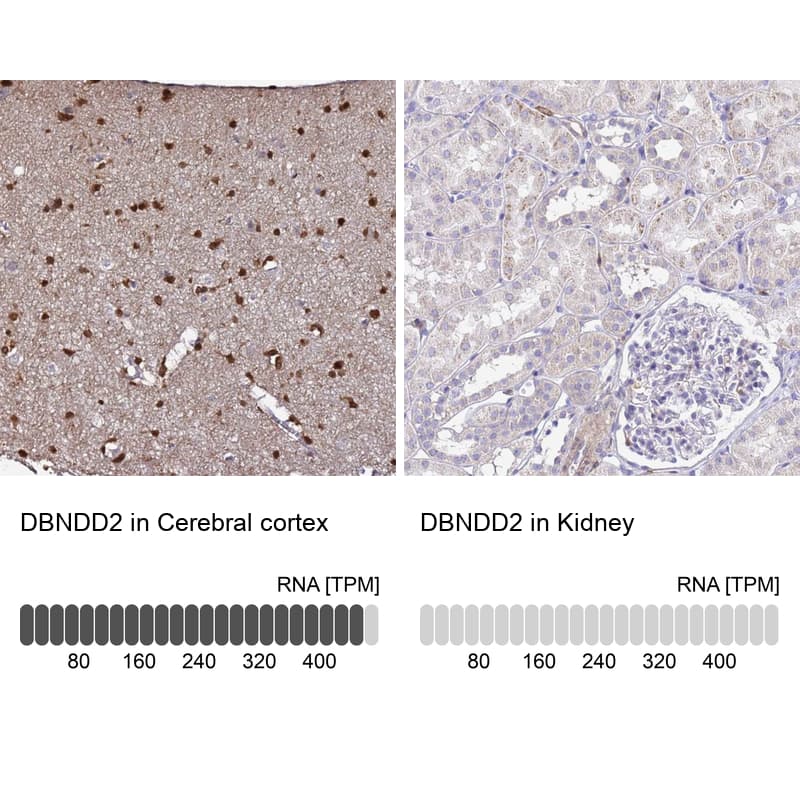 Immunohistochemistry DBNDD2 Antibody - BSA Free