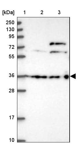 Lane 1: Marker [kDa] 250, 130, 95, 72, 55, 36, 28, 17, 10Lane 2: Human cell line RT-4Lane 3: Human cell line U-251MG sp