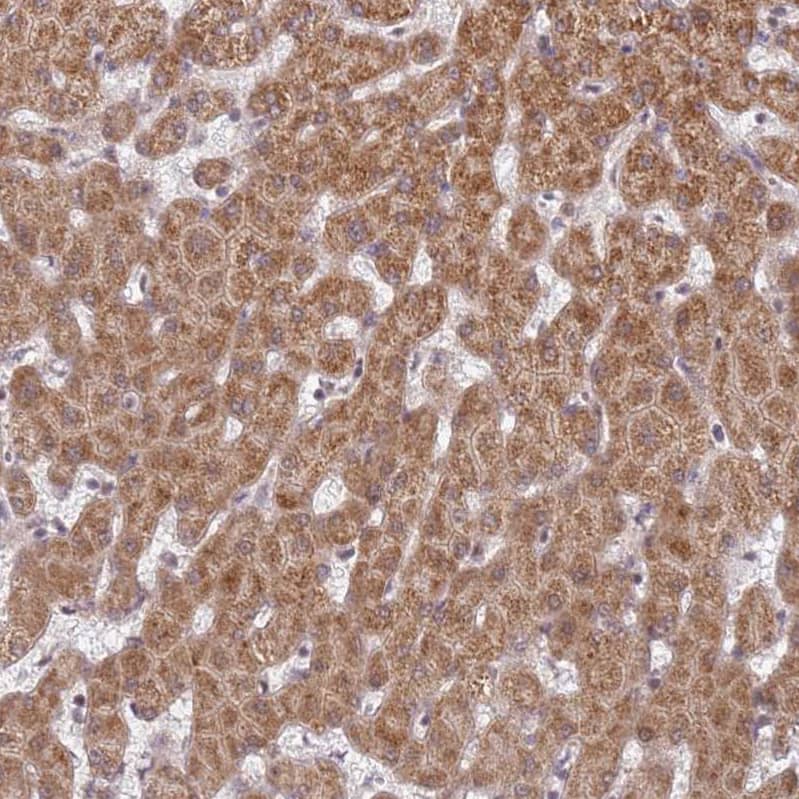 Staining of human liver shows strong cytoplasmic positivity in hepatocytes.