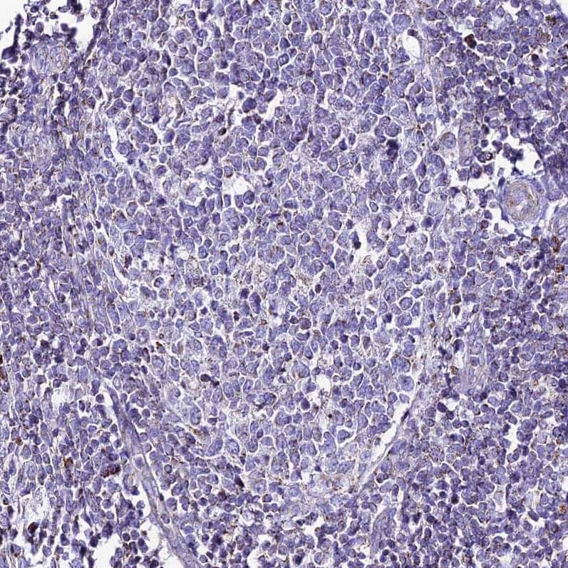 Staining of human tonsil shows very weak granular cytoplasmic positivity in germinal center cells.