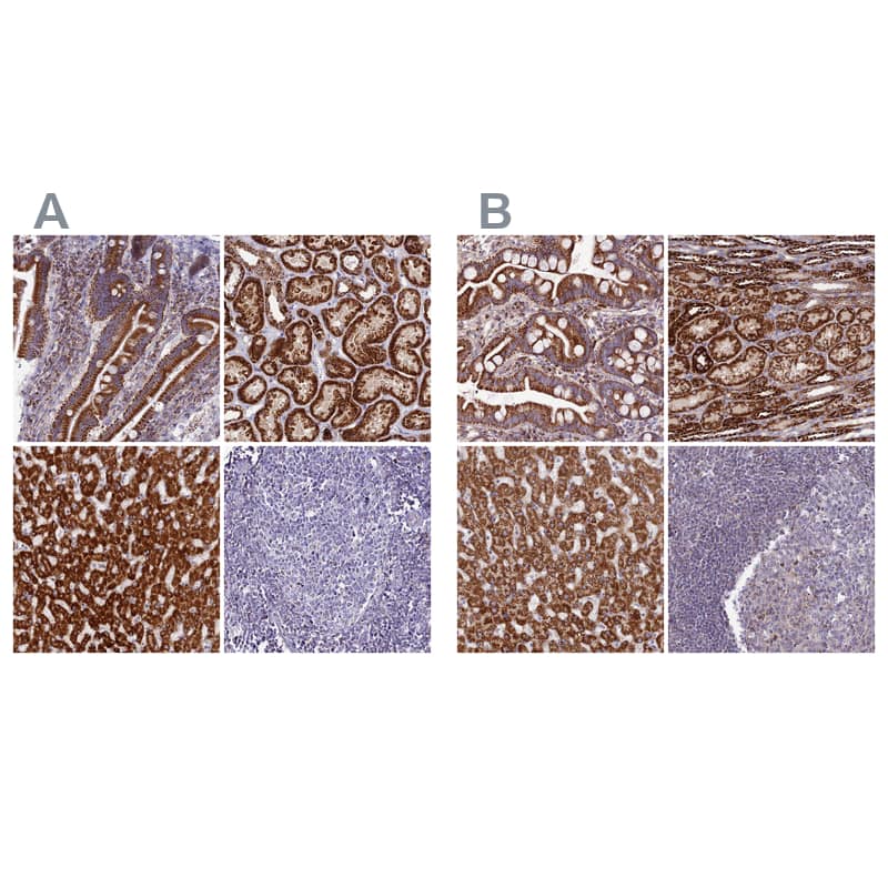 Staining of human duodenum).