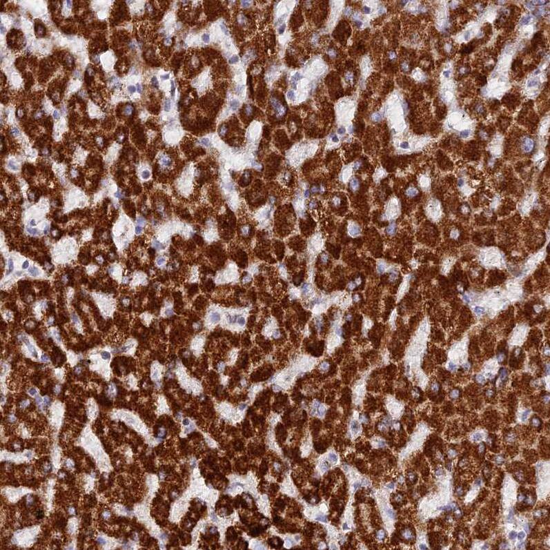 Staining of human liver shows strong granular cytoplasmic positivity in hepatocytes.