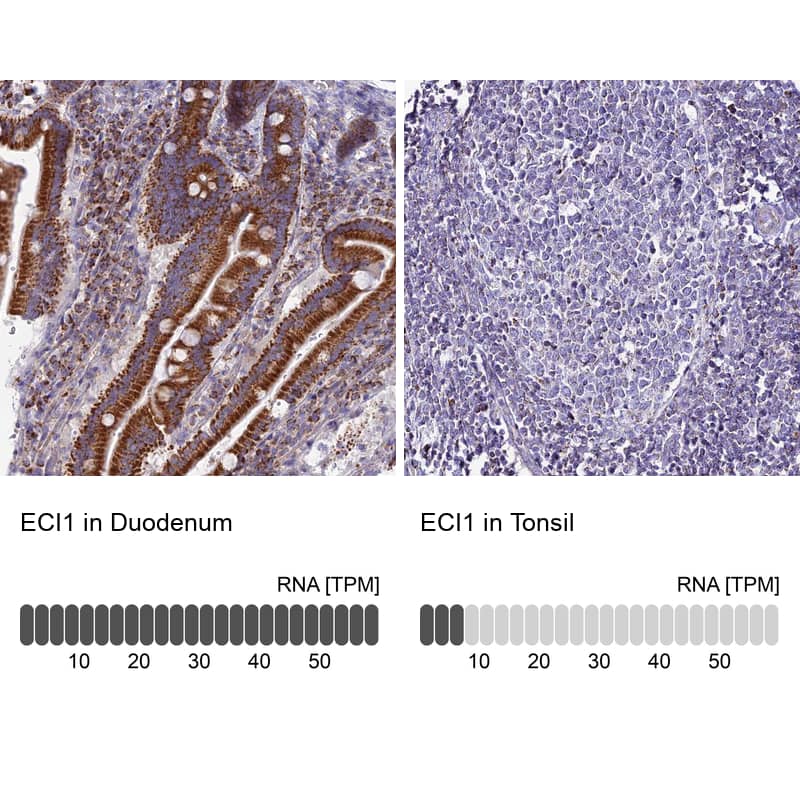 <b>Orthogonal Strategies Validation. </b>Analysis in human duodenum and tonsil tissues using NBP1-91821 antibody. Corresponding ECI1 RNA-seq data are presented for the same tissues.