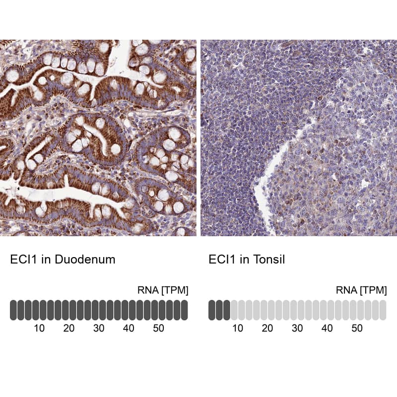 Analysis in human duodenum and tonsil tissues using NBP1-91822 antibody. Corresponding ECI1 RNA-seq data are presented for the same tissues.