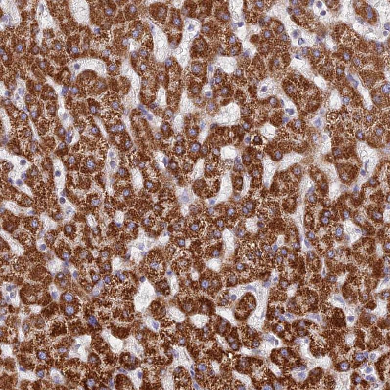 Staining of human liver shows strong granular cytoplasmic positivity in hepatocytes.