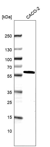 Analysis in human cell line CACO-2.
