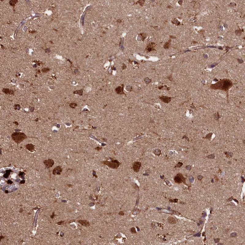 Staining of human cerebral cortex shows strong cytoplasmic and nuclear positivity in neuronal cells.