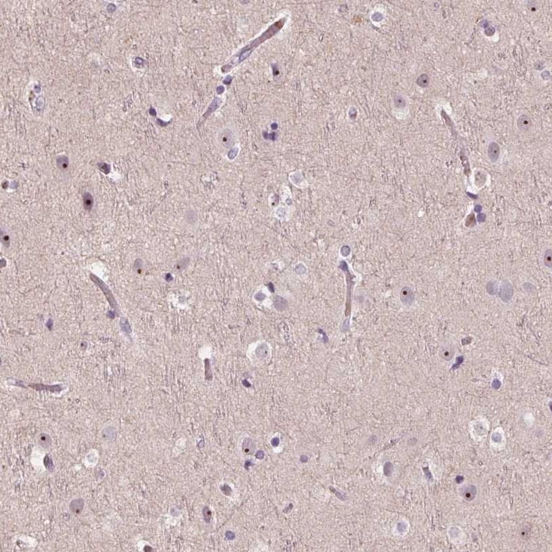 Staining of human cerebral cortex shows strong positivity in nucleoli in neurons.