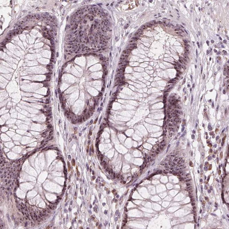 Staining of human rectum shows strong positivity in nucleoli in glandular cells.