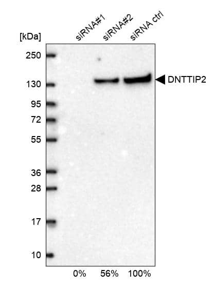 Analysis in U2OS cells transfected with control siRNA, target specific siRNA probe #1 and #2. Remaining relative intensity is presented.