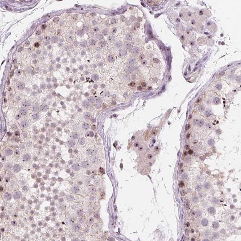 Staining of human testis shows strong positivity in nucleoli in Leydig cells and seminiferous duct cells.