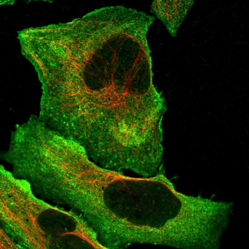 Staining of human cell line U-2 OS shows localization to plasma membrane & cytosol.
