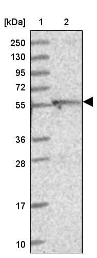 Lane 1: Marker [kDa] 250, 130, 95, 72, 55, 36, 28, 17, 10Lane 2: Human cell line RT-4