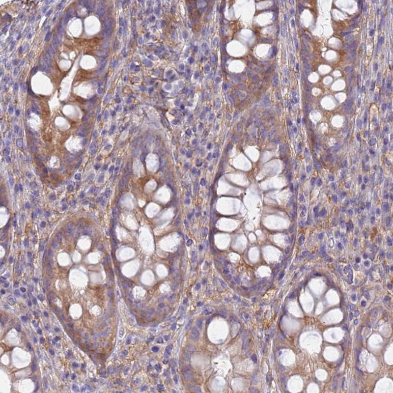 Staining of human rectum shows moderate cytoplasmic positivity in glandular cells.