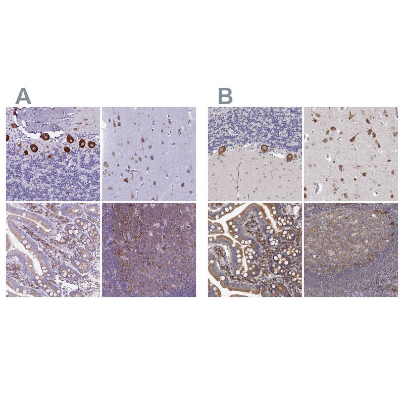 <b>Orthogonal Strategies Validation. </b>Staining of human cerebellum, cerebral cortex, gastrointestinal and lymphoid tissues HPA040688 (A) shows similar protein distribution across tissues to independent antibody HPA055316 (B).