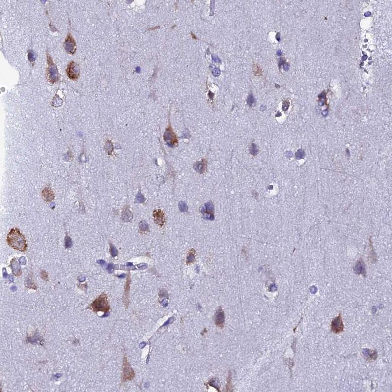 Staining of human cerebral cortex shows strong cytoplasmic positivity in neurons.