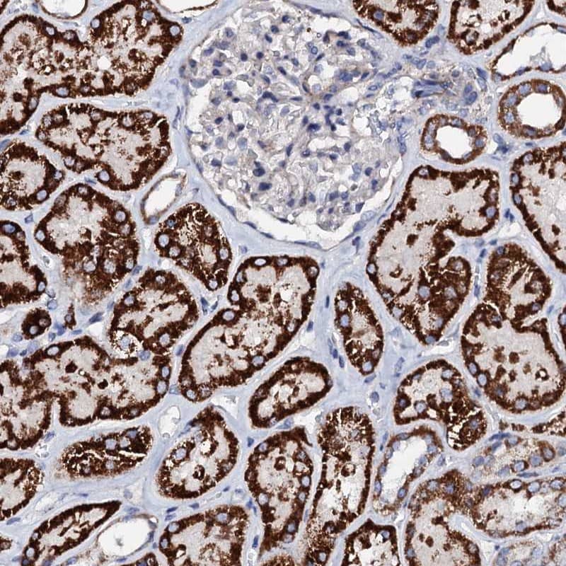 Staining of human kidney shows strong granular cytoplasmic positivity in cells in renal tubules.