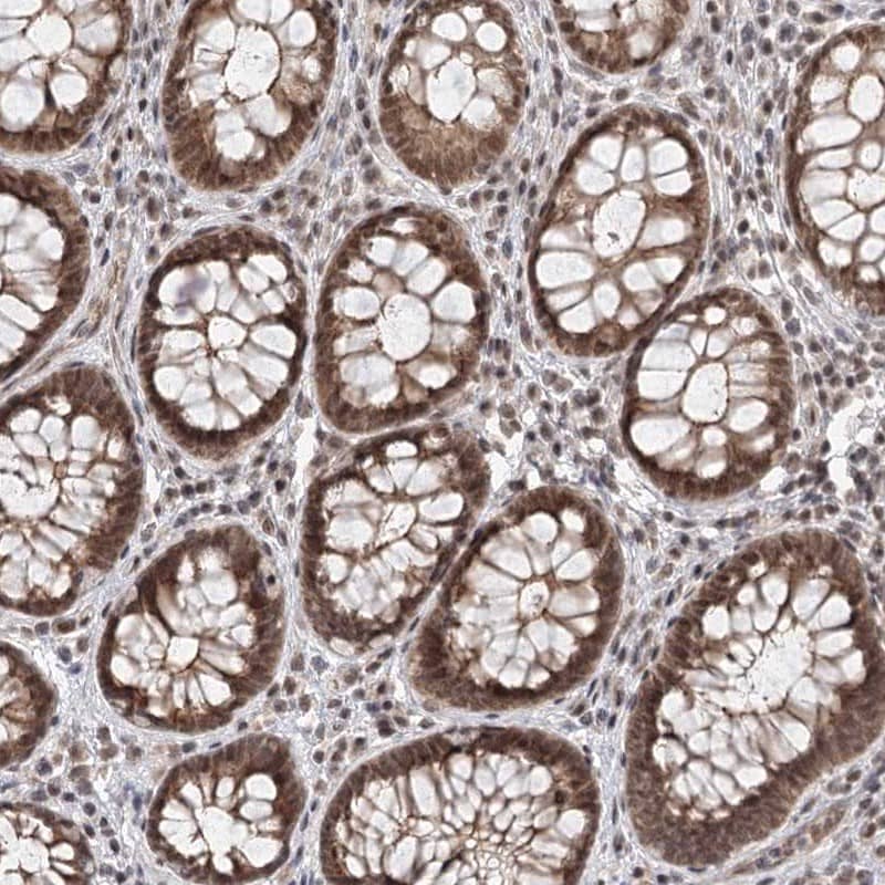 Immunohistochemistry-Paraffin FAM13C1 Antibody - BSA Free