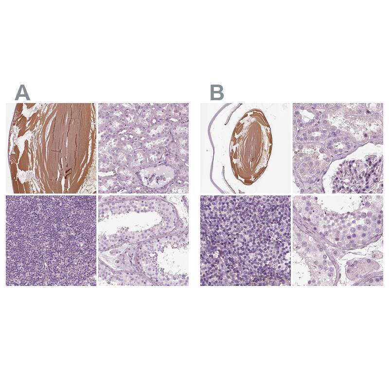 Immunohistochemistry-Paraffin Filensin Antibody - BSA Free